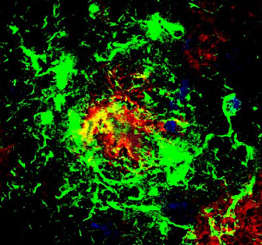 astrocytes- the 'star-shaped' cell of the CNS