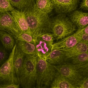 Here we have bronchial epithelial cells stained with DAPI and phalloidin using the reverse primary colours; nuclei are stained with DAPI shown in magenta, and phalloidin stained with a rhodamine probe shown in yellow.”