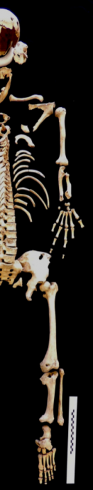 dwarf skeleton