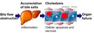 Murine precision-cut liver slices as a disease model to predict drug-induced cholestasis