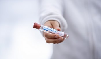 Image of test tube