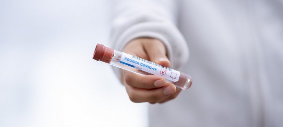 Image of test tube