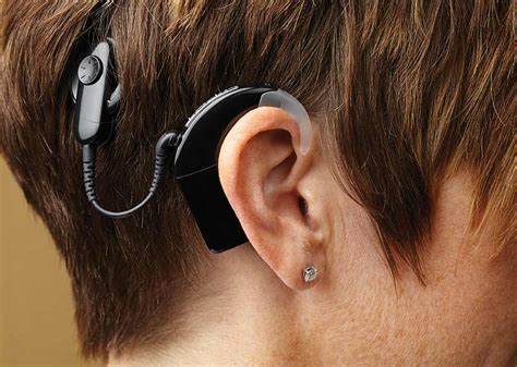 This image shows a person with a fitted cochlear implant.
