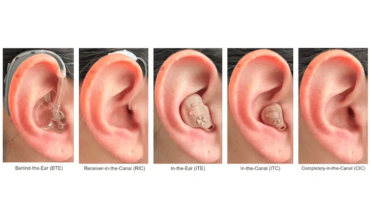 Images of five ears with different hearing aids in. 