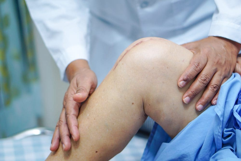 Photo of Doctor holding a post-op knee